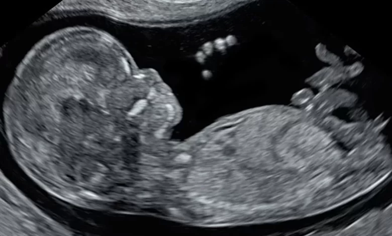 Prenatal Scans 