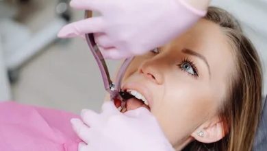 Private Dental Charges Tooth Extraction